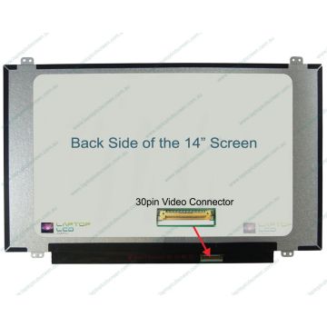 METABOX P641RF Replacement Laptop LCD Screen Panel